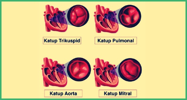 Type de valve cardiaque